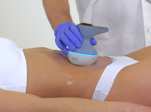 BTL Exion - Body Session