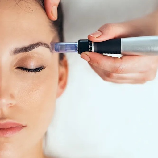 BTL Exion - Fractional RF Micro-needling (Face)
